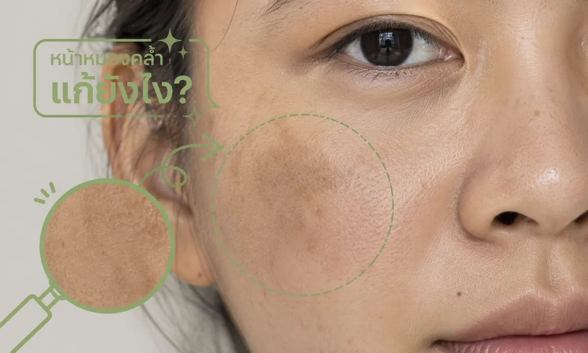 หน้าหมองคล้ำและแนวทางดูแลผิวให้ดูใสขึ้น