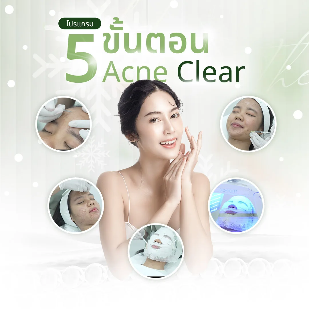 ภาพประกอบโปรแกรม Acne Clear 5 ขั้นตอน