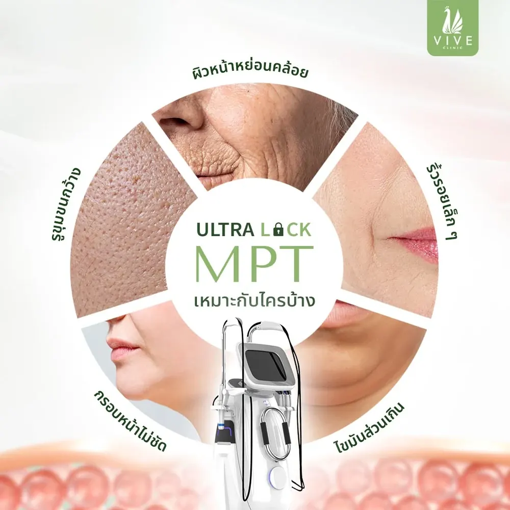 Ultra Lock MPT เหมาะกับกรอบหน้าไม่ชัด เหนียง ผิวหย่อนคล้อย และริ้วรอยเล็ก ๆ